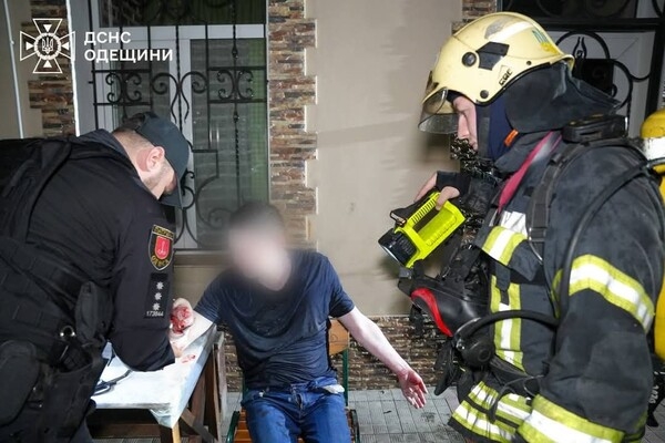 В Приморском районе Одессы горела квартира: пострадал мужчина