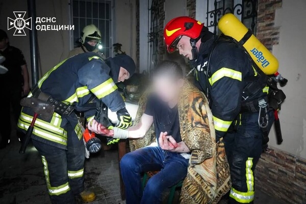 В Приморском районе Одессы горела квартира: пострадал мужчина