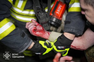 В Приморском районе Одессы горела квартира: пострадал мужчина