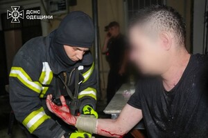 В Приморском районе Одессы горела квартира: пострадал мужчина